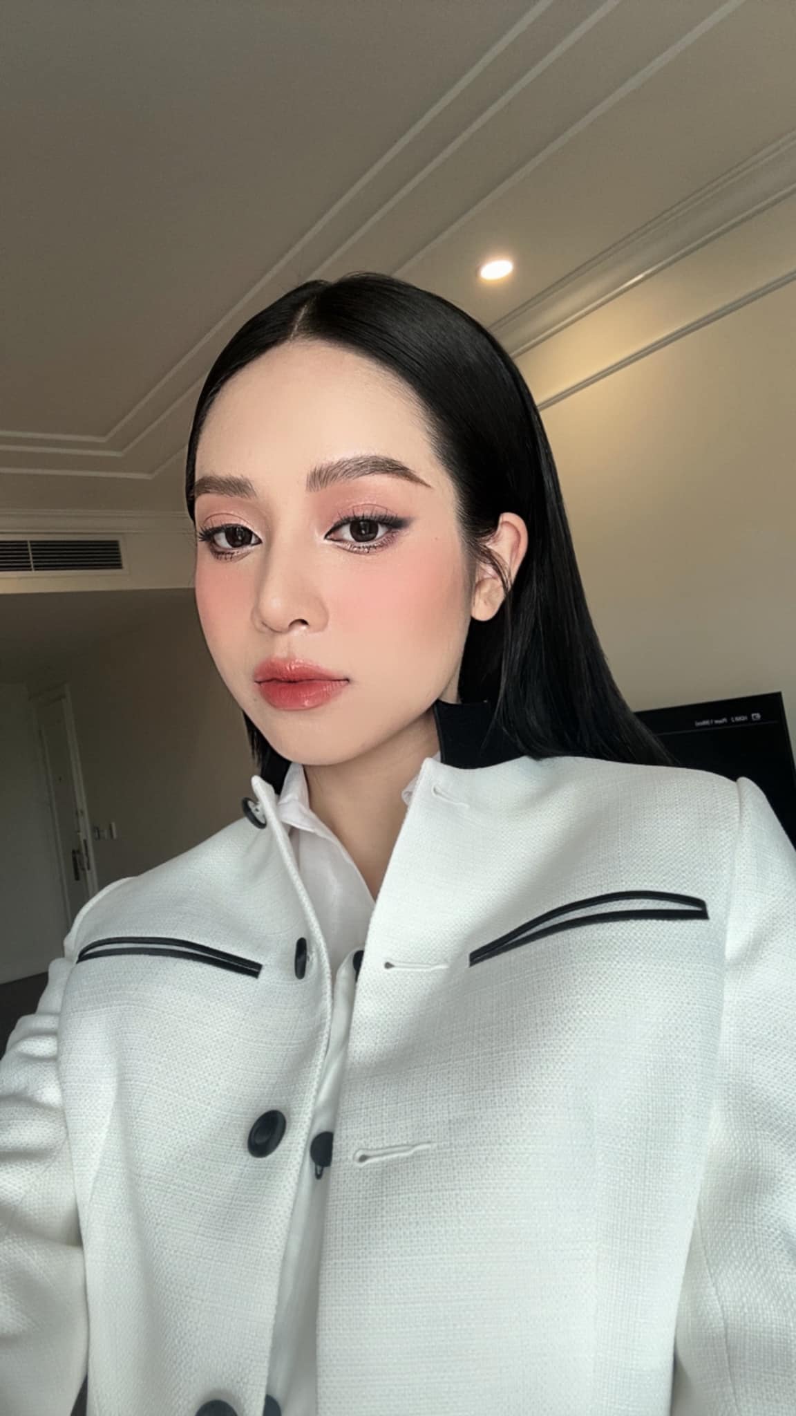 Hoa hậu Thanh Thủy bất ngờ công khai phẫu thuật thẩm mỹ