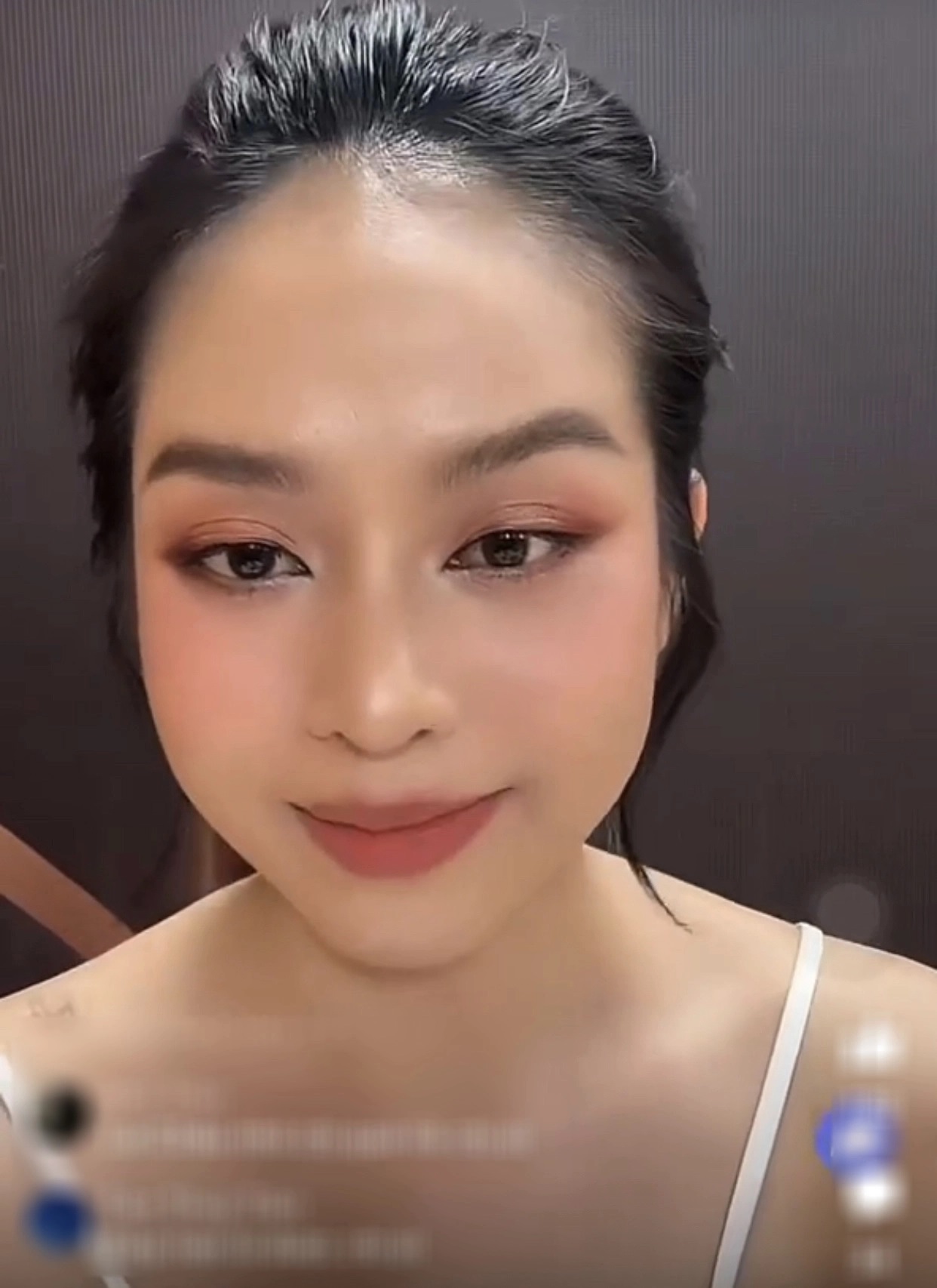 Hoa hậu Thanh Thủy bất ngờ công khai phẫu thuật thẩm mỹ